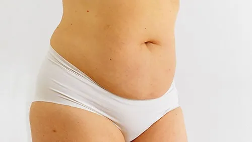 Imagem Bioestimuladores de colágeno para tratamento de flacidez leve, “umbigo triste” e celulite